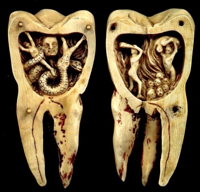 The Tooth Worm As Hell’s Demon’, The 18th-Century Depiction Of The Tooth Worm Believed By Many In The Past To Bore Holes In Teeth And Cause Toothaches