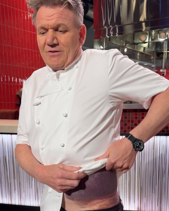 "I’m Lucky To Be Here": Gordon Ramsay Flooded With Recovery Wishes After Harrowing Accident "I’m Lucky To Be Here": Gordon Ramsay Flooded With Recovery Wishes After Harrowing Accident