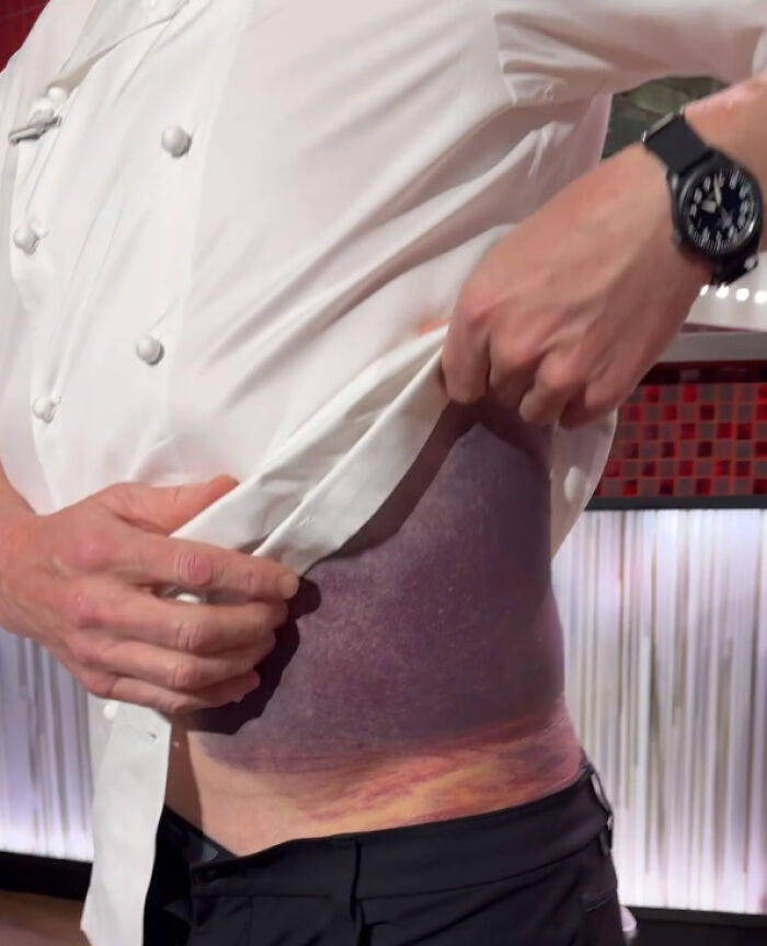 "I’m Lucky To Be Here": Gordon Ramsay Flooded With Recovery Wishes After Harrowing Accident "I’m Lucky To Be Here": Gordon Ramsay Flooded With Recovery Wishes After Harrowing Accident