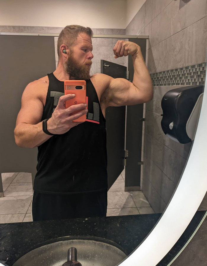 Man Raises $76k To Surgically Remove Excess Skin After Huge Weight-Loss Transformation