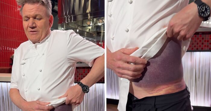 “I’m Lucky To Be Here”: Gordon Ramsay Flooded With Recovery Wishes After Harrowing Accident