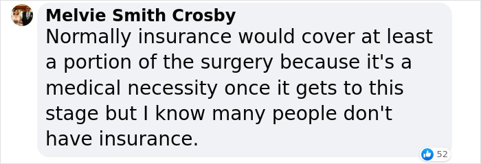 Man Raises $76k To Surgically Remove Excess Skin After Huge Weight-Loss Transformation