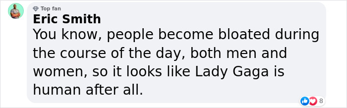 &ldquo;Leave Women Alone&rdquo;: Lady Gaga Snaps Back With Sassy Post After Rumors Surface That She&rsquo;s Pregnant