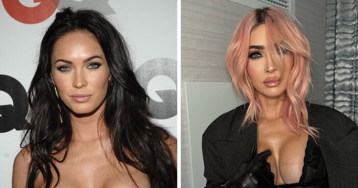 26 Celebrities Before And After Plastic Surgery, Kim Kardashian And Ariana Grande Included