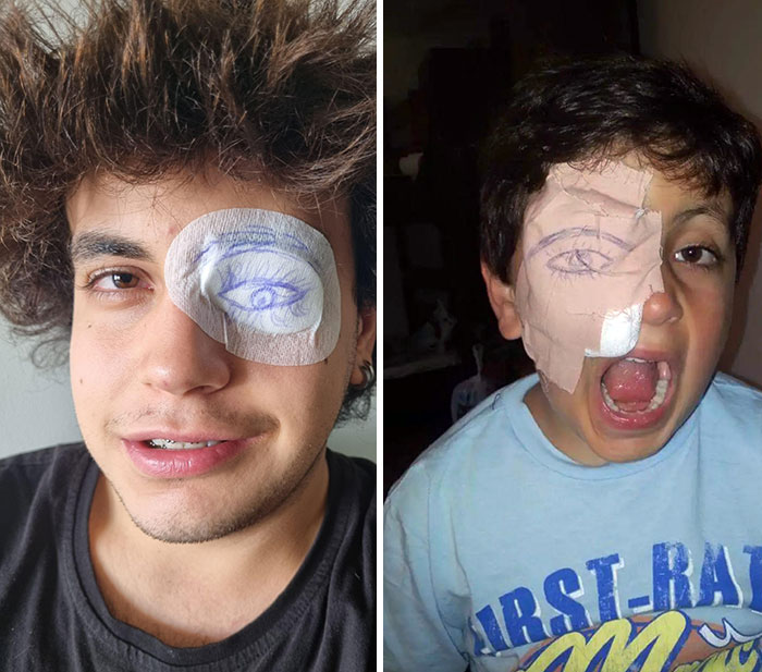 10 Years Ago, I Got Sand In My Eyes. Now I Got Iron Bits. Both Of The Times My Dad Drew Me Fake Eyes