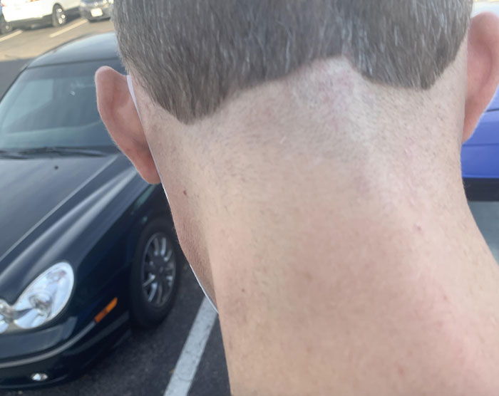 When The Stylist Says, "I'm Having A Tough Time With Your Hair Line"