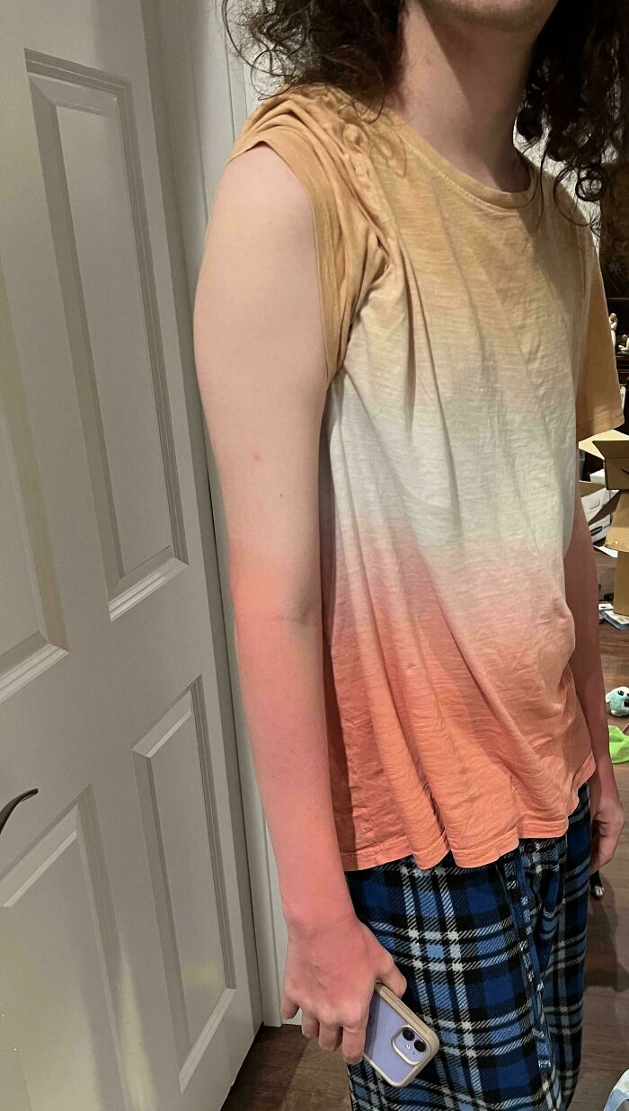 My Son’s Sunburn Matches The Gradient Of His Shirt