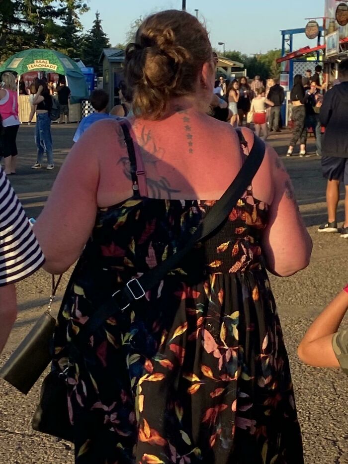 Missed A Spot With The Sunscreen