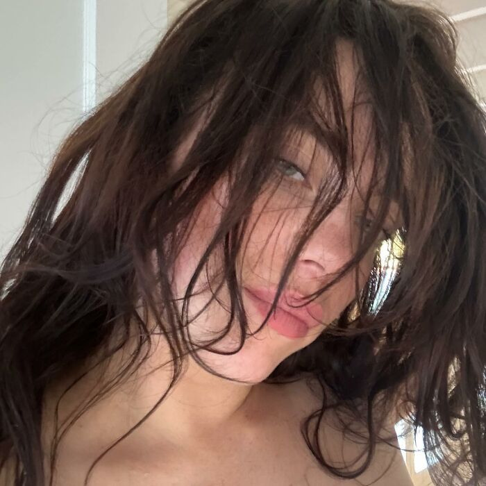 &ldquo;I&rsquo;m Drooling&rdquo;: Billie Eilish Reveals Mystery Bite Marks Along With Rare Bikini Post