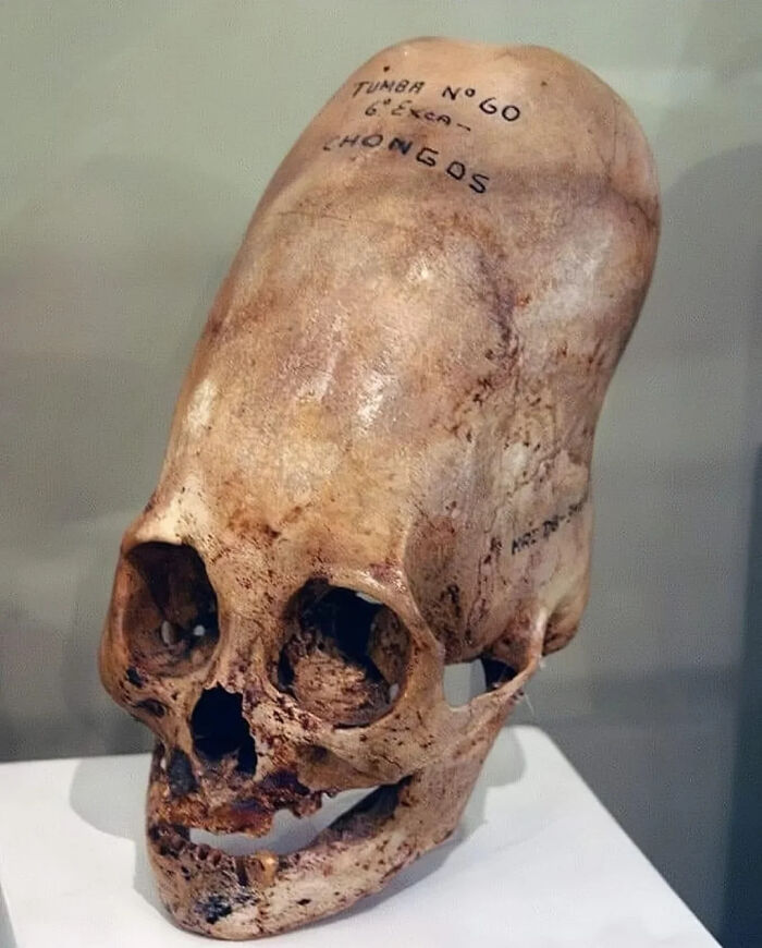 Calavera extrañamente aterradora con inscripción en la parte superior de una vitrina.