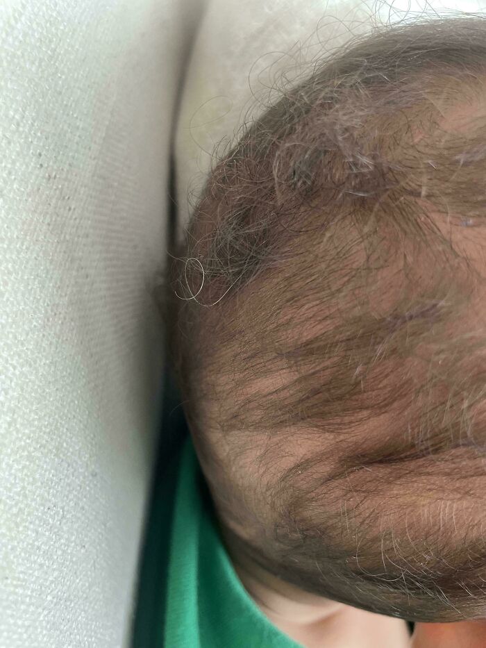 My 1yr Old Son Has A Single Grey Hair