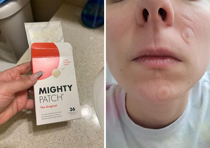 This Pimple Patch Is The Invisibility Cloak Your Zit Wishes It Had.