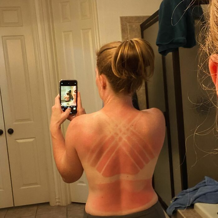 Just A Friendly Public Service Announcement: Make Sure Your Sunblock Is Not Expired And You Actually Use It