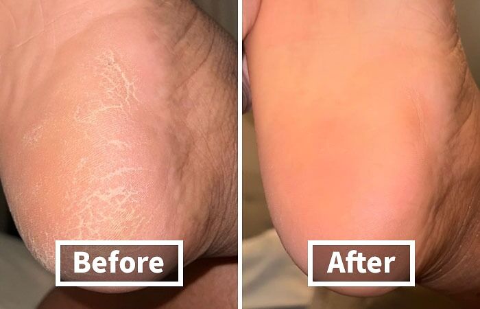 It Seems Like Prime Day Was The Perfect Excuse For Pandas To Pamper Their Paws Thanks To Callus Remover Gel