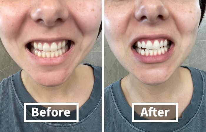 Honourable Mention: Venus Visage V34 Colour Corrector Toothpaste Might Look Weird, But It's Like Photoshop For Your Smile