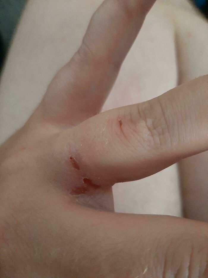 Took My Ring Off After 15 Years