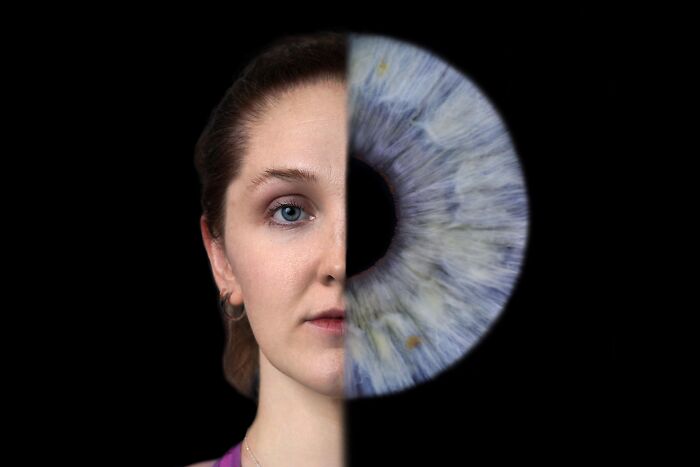 I Photographed The Irises Of The Paralympic GB Team, And My Works Got Exhibited In London