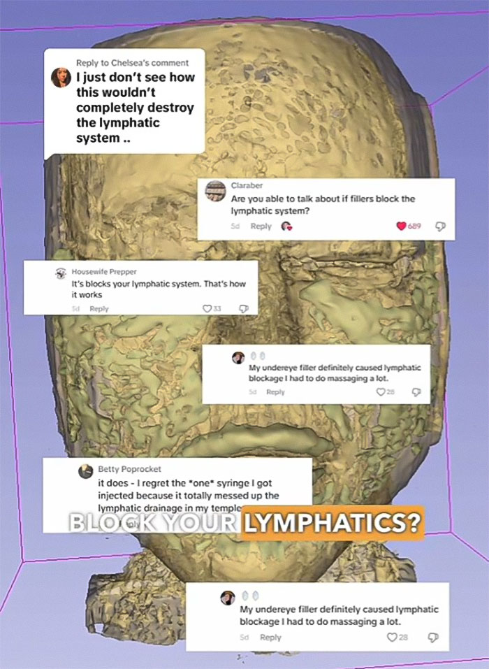 &ldquo;Never Getting Fillers&rdquo;: After MRI Of Woman Stuns Viewers, Doctor Discusses Effects