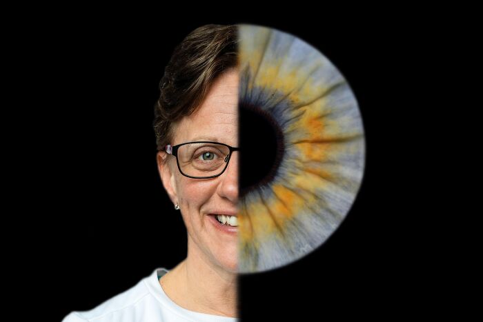 I Photographed The Irises Of The Paralympic GB Team, And My Works Got Exhibited In London