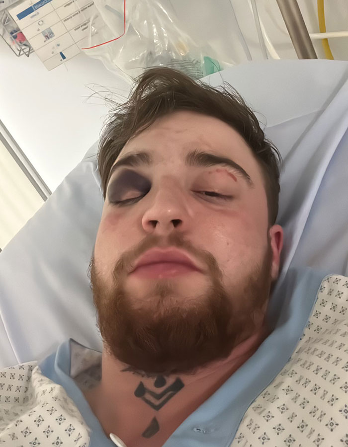 29-Year-Old Trans Man Gets Brutally Beaten Up In Switzerland, Claims It&rsquo;s A Hate Crime