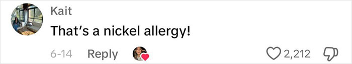 Woman Realizes She&rsquo;s Been &ldquo;Accidentally Poisoning&rdquo; Herself For Months After Removing Earrings