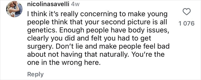 Comment discussing Gracie Bon ody transformation, surgery, and genetics concerns related to social media influence.