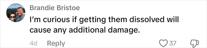 &ldquo;Never Getting Fillers&rdquo;: After MRI Of Woman Stuns Viewers, Doctor Discusses Effects