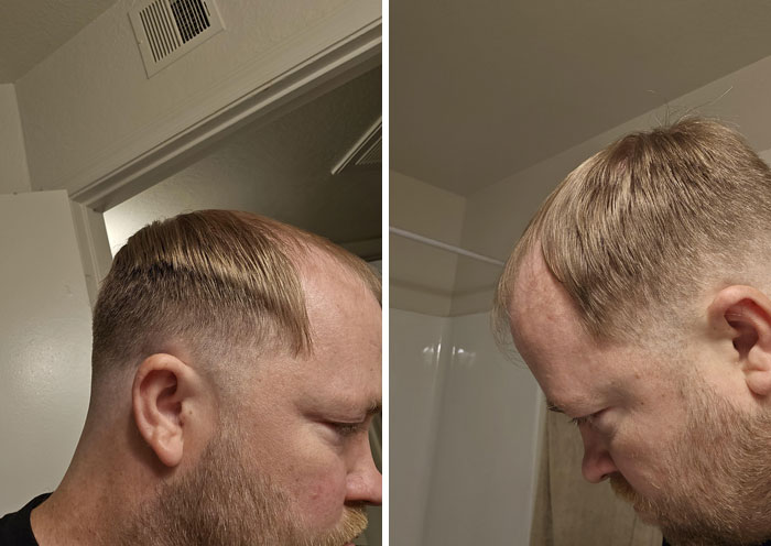 Asked For A Fade And Got This. One Side Is Kind Of Faded, The Other Isn't