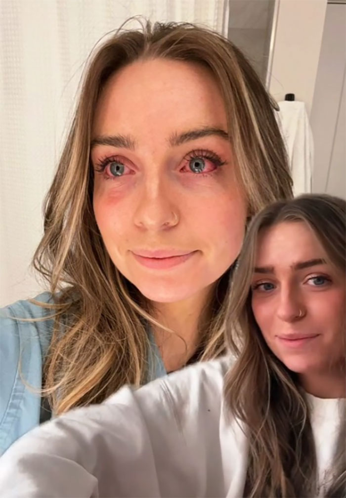 Woman Realizes She&rsquo;s Been &ldquo;Accidentally Poisoning&rdquo; Herself For Months After Removing Earrings