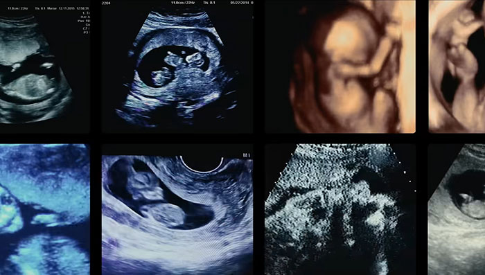 Netflix’s “The Man With 1,000 Kids” Stuns As Viewers Want To Lock Up Jonathan Jacob Meijer Netflix’s “The Man With 1,000 Kids” Stuns As Viewers Want To Lock Up Jonathan Jacob Meijer