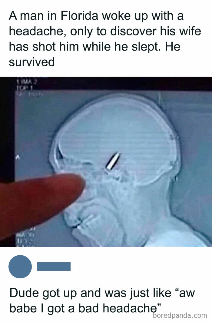 X-ray of a man's head with a bullet, finger pointing; funny random meme text appears above and below.