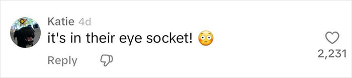 MRI Of 33-Year-Old Woman&rsquo;s Face Reveals Where All Her Filler Went