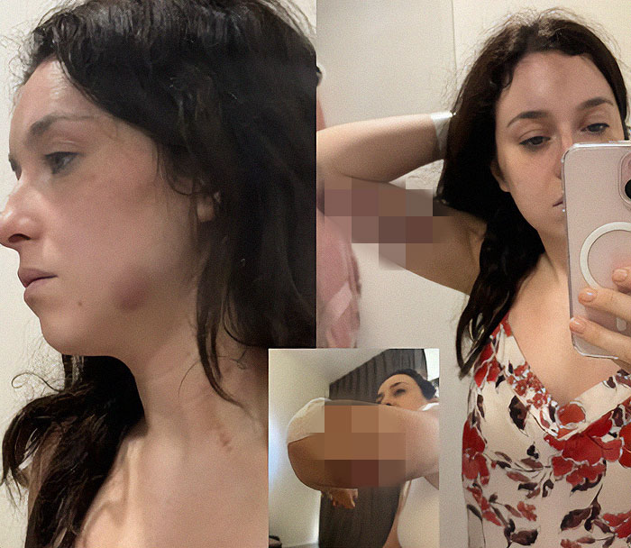 Flight Attendant Arrested In Dubai After Her Husband Attacked Her