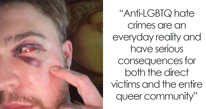 29-Year-Old Trans Man Gets Brutally Beaten Up In Switzerland, Claims It’s A Hate Crime