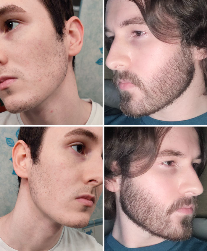 How It Started vs. How It's Going (1-Year Update)