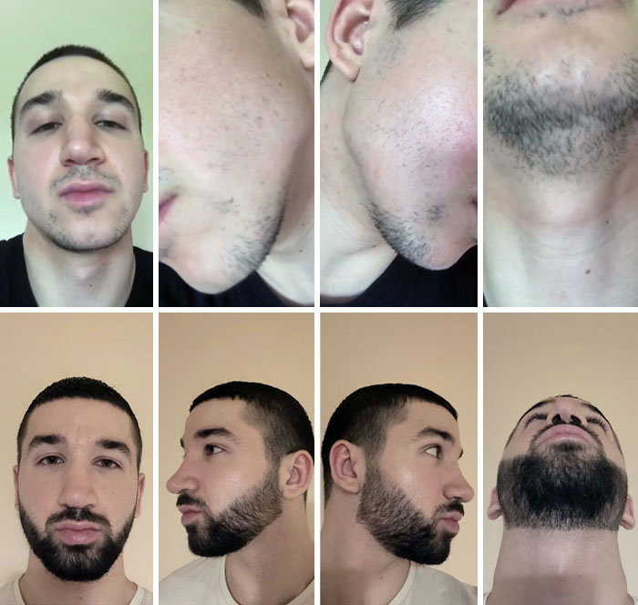 Month 28. Before vs. After