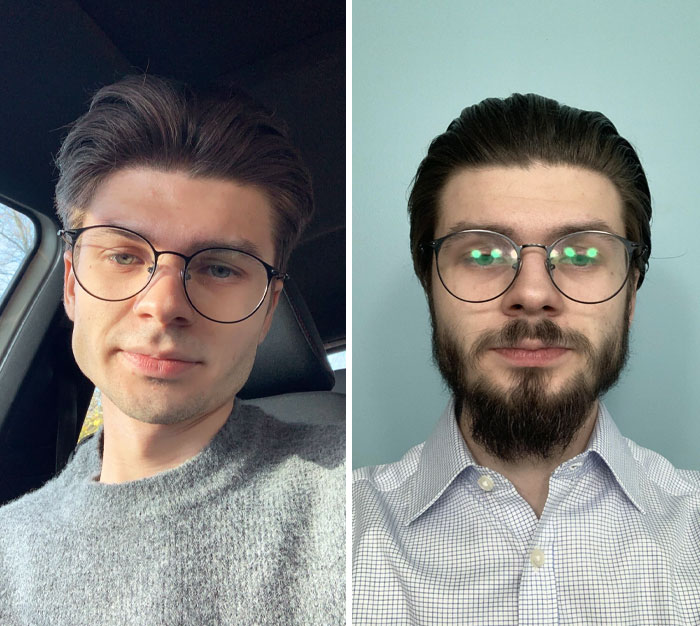 3 Months Of Beard Growth. I Can’t Decide Whether Or Not It Is Too Patchy