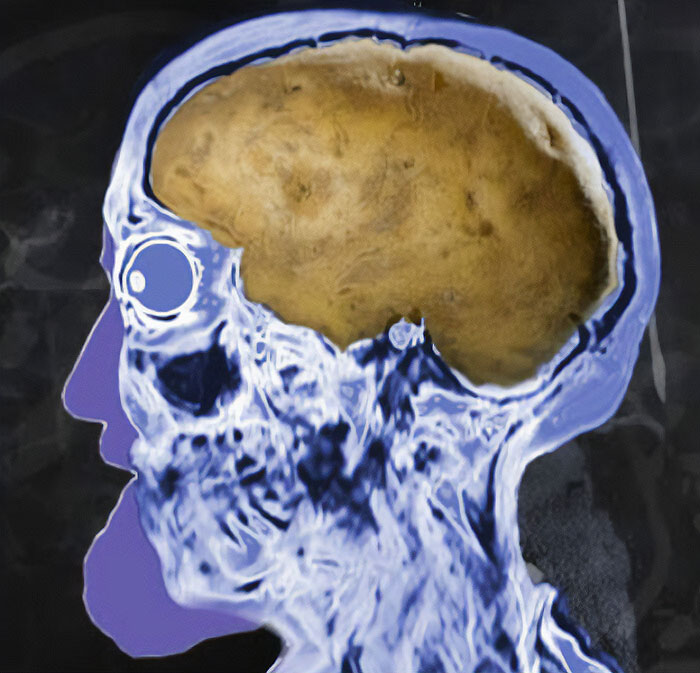 Funny-Reaction-Memes-Acting-Dumb