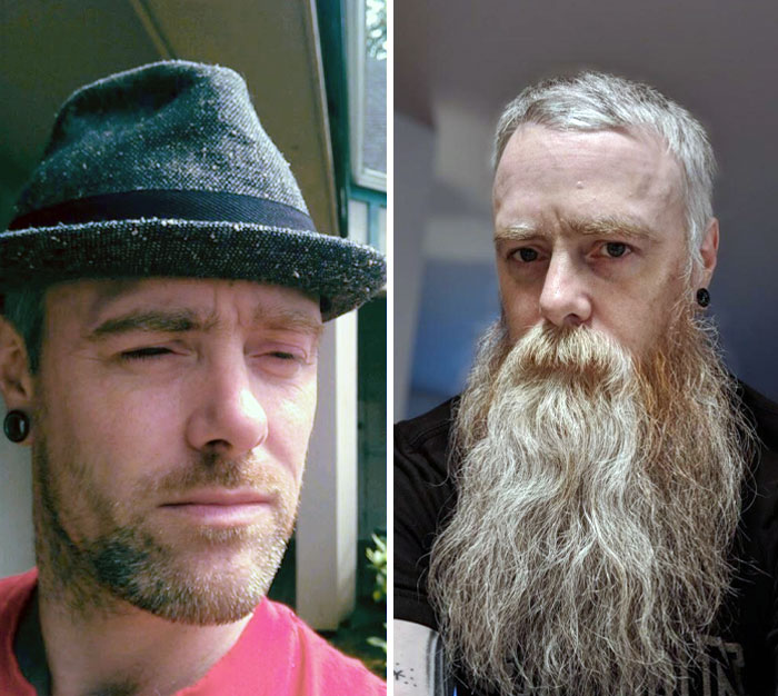 Before vs. After. It's Already Been 10 Years