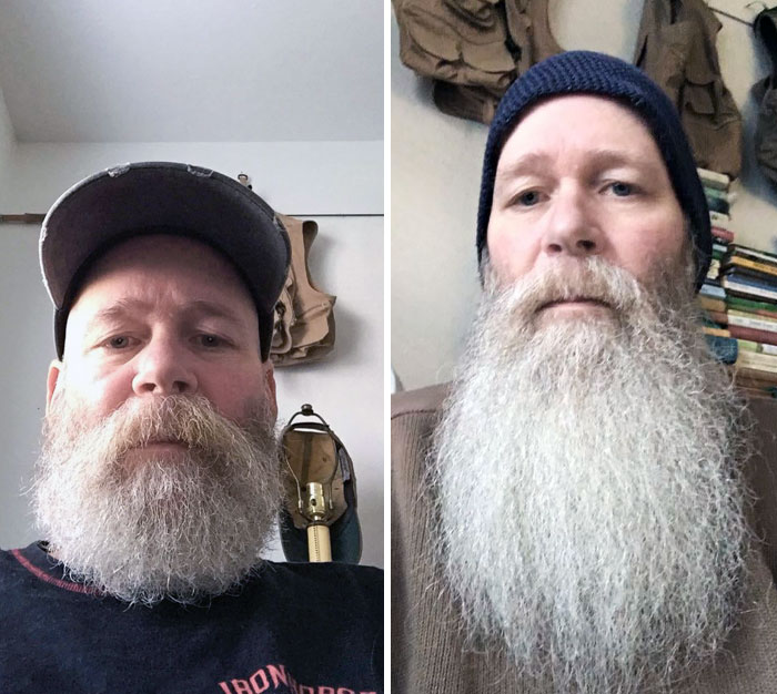 I Wanted To Show You How One Year Can Change Your Beard