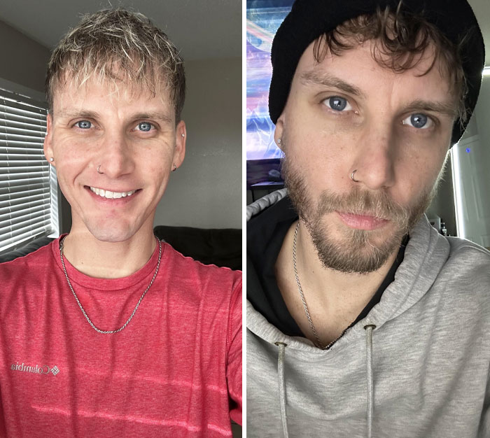 Baby Face Or Beard? 7 Weeks Of Growth 