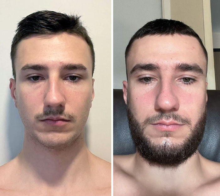 I’m Trying To Grow A Beard For The First Time