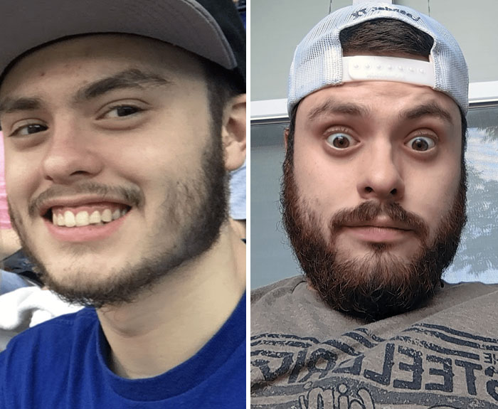Beard At 19 vs. Beard Now At 25. I Still Have Work To Do, But I'm Glad It Looks So Much Better Than When I Started