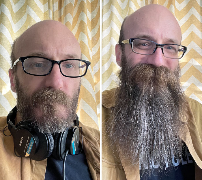 One Year Of Beard Growth