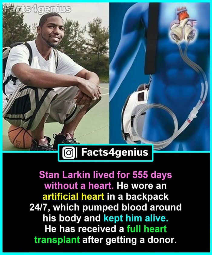 Man holding basketball; on the right, an illustration of an artificial heart in a backpack. Interesting facts for genius.