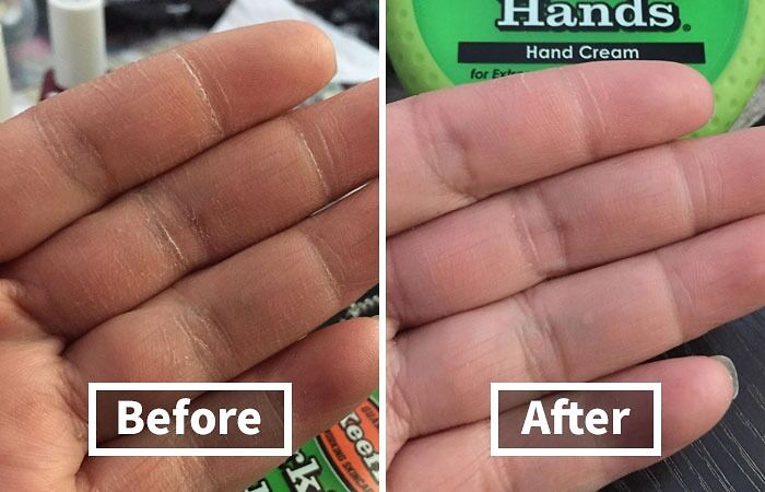 Close-up comparison of dry hands before and after applying beauty hand cream from popular beauty buys.