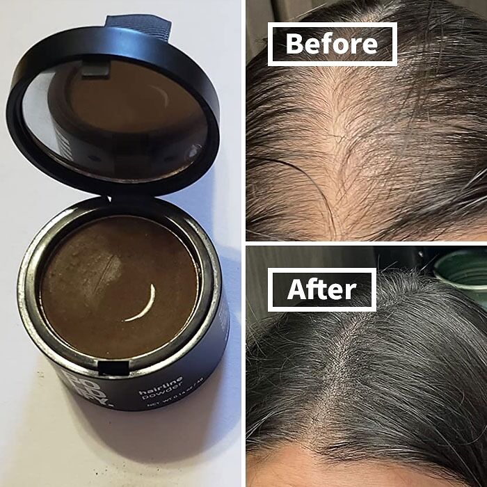 Bald Spots Got You Feeling Less Than Fabulous? Sevich Hairline Powder Will Create The Illusion Of Thicker, Fuller Hair In Seconds