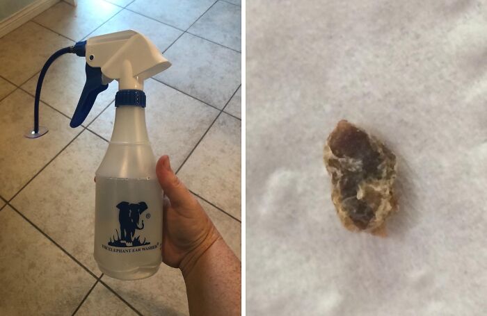 Hand holding a beauty ear washer spray bottle next to a close-up of an extracted earwax piece on a white background.