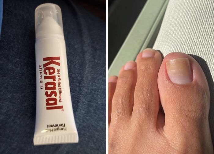 Tube of Kerasal nail treatment cream on fabric next to close-up of a healthy toenail, highlighting beauty buys.