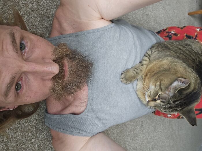 Simon Assisting Me With A Torn Back Muscle